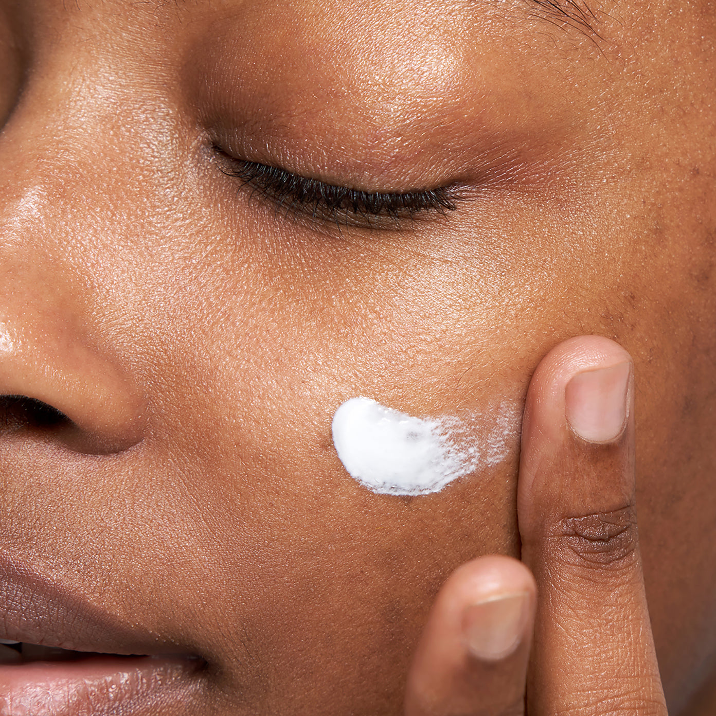Rescue Balm - Post Spot Repair