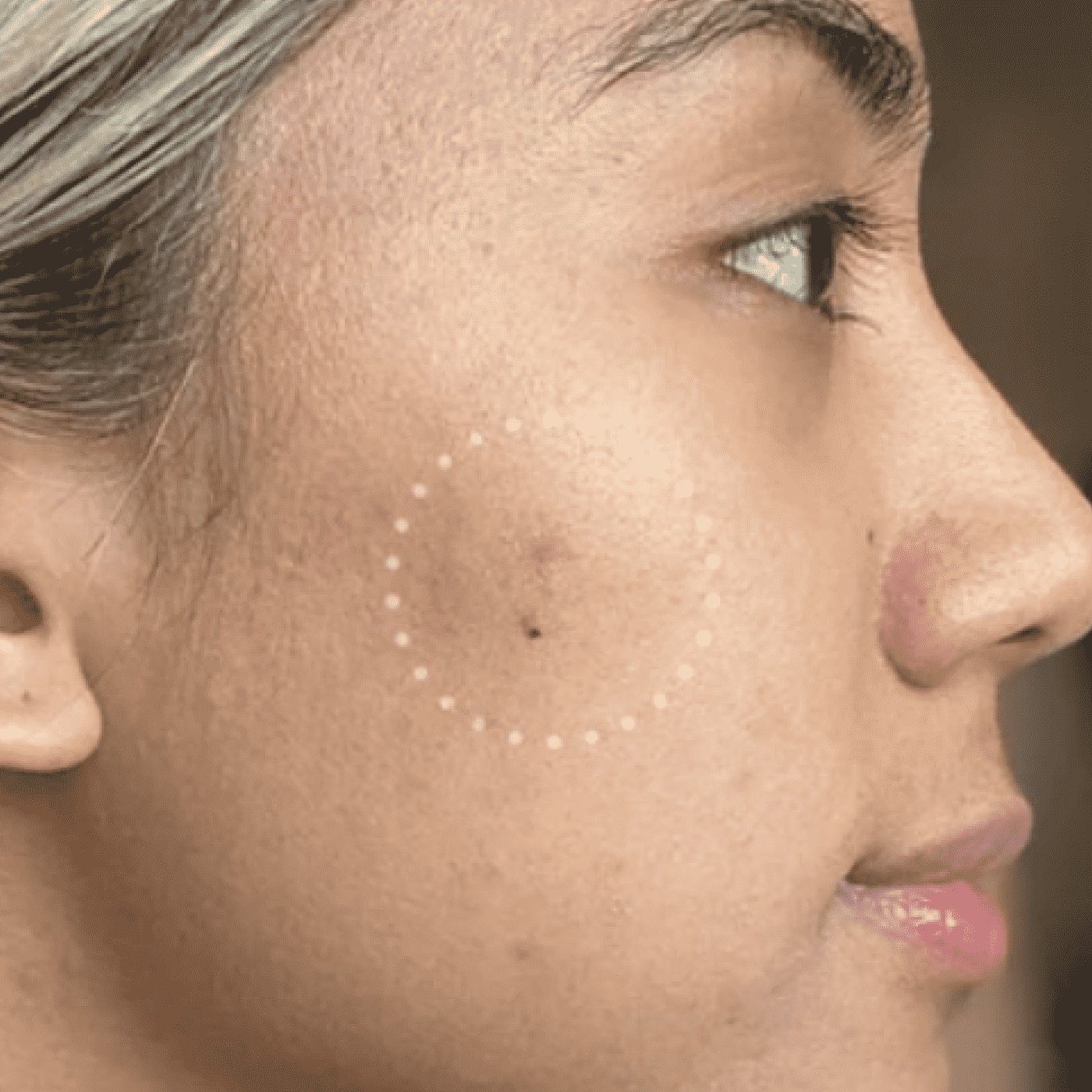 Mighty Patch™ for Dark Spots - Clear Tone Care