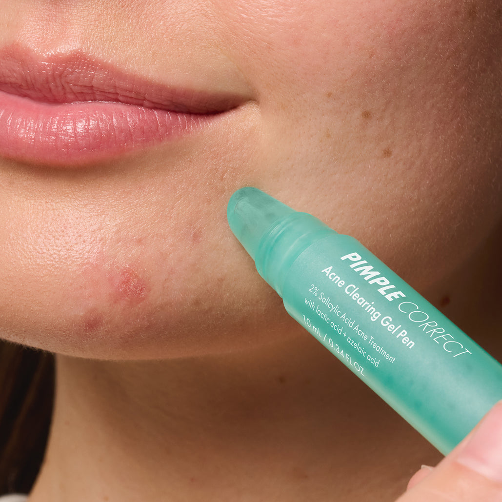 Pimple Correct - Quick Stage Fix