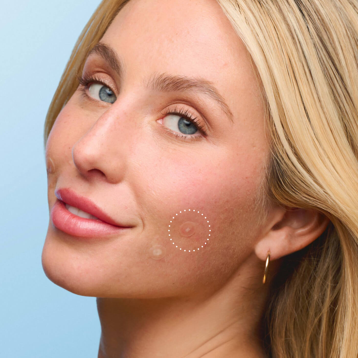 Mighty Patch™ Mini Invisible+ - Barely There Care