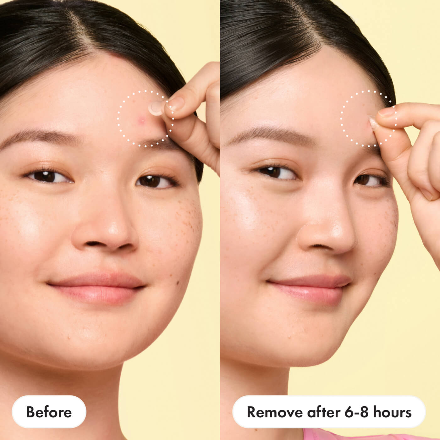 Mighty Patch™ Mini Invisible+ - Barely There Care